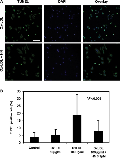 Figure 4