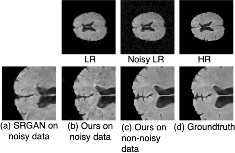 Figure 15