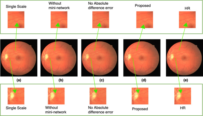 Figure 16