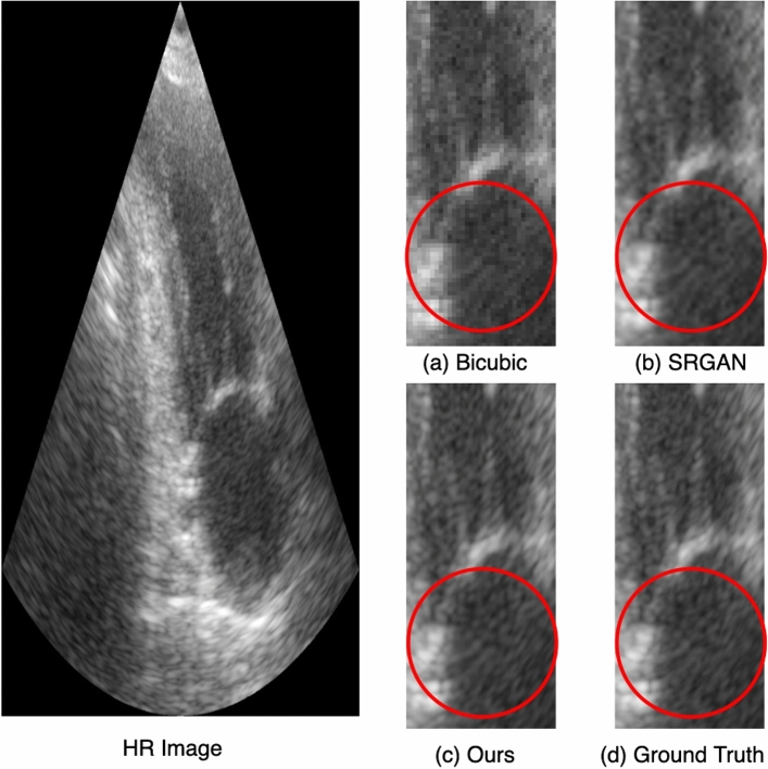 Figure 13