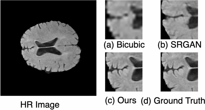 Figure 12