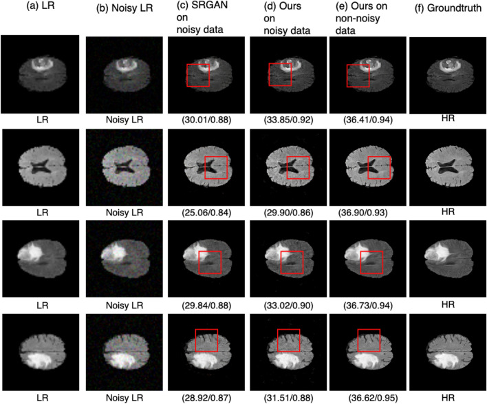 Figure 14