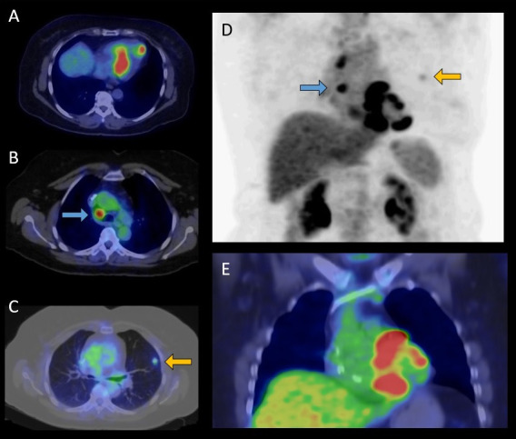 Fig. 3.