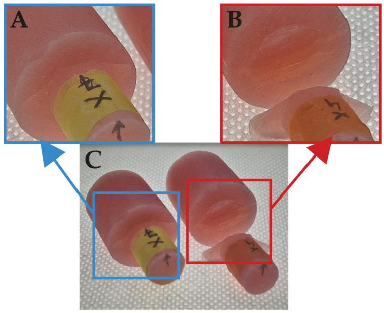 Figure 14