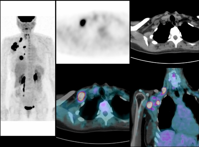 Fig. 2