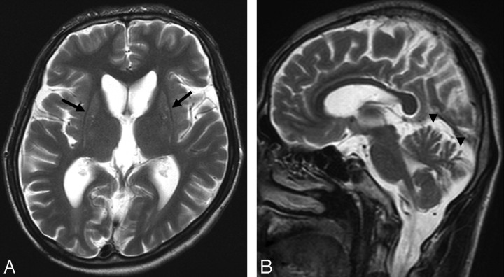 Fig 1.