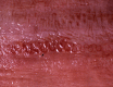 Fig. 16