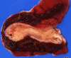 Fig. 44