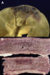 Fig. 46