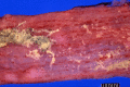 Fig. 42