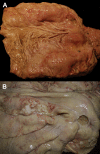 Fig. 41