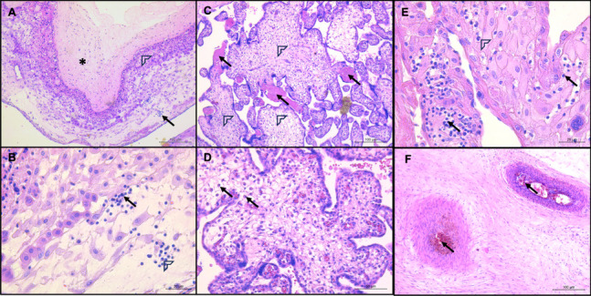 Fig. 1