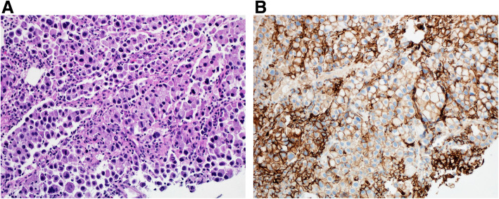 Fig. 11