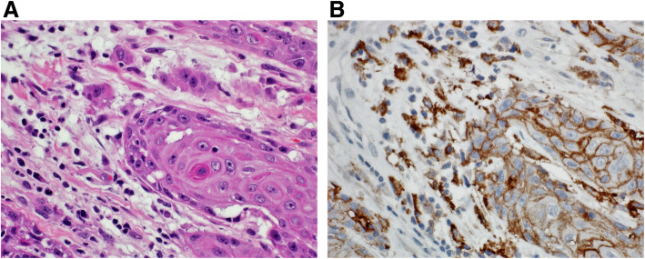 Fig. 13