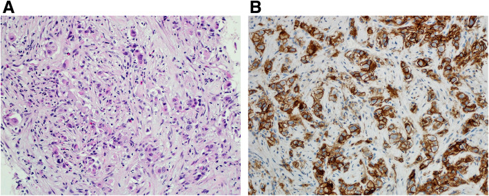 Fig. 12