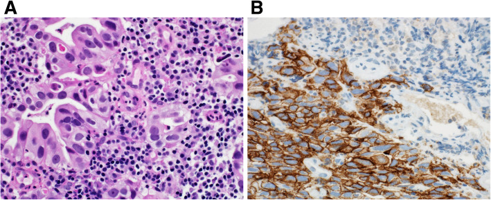 Fig. 15