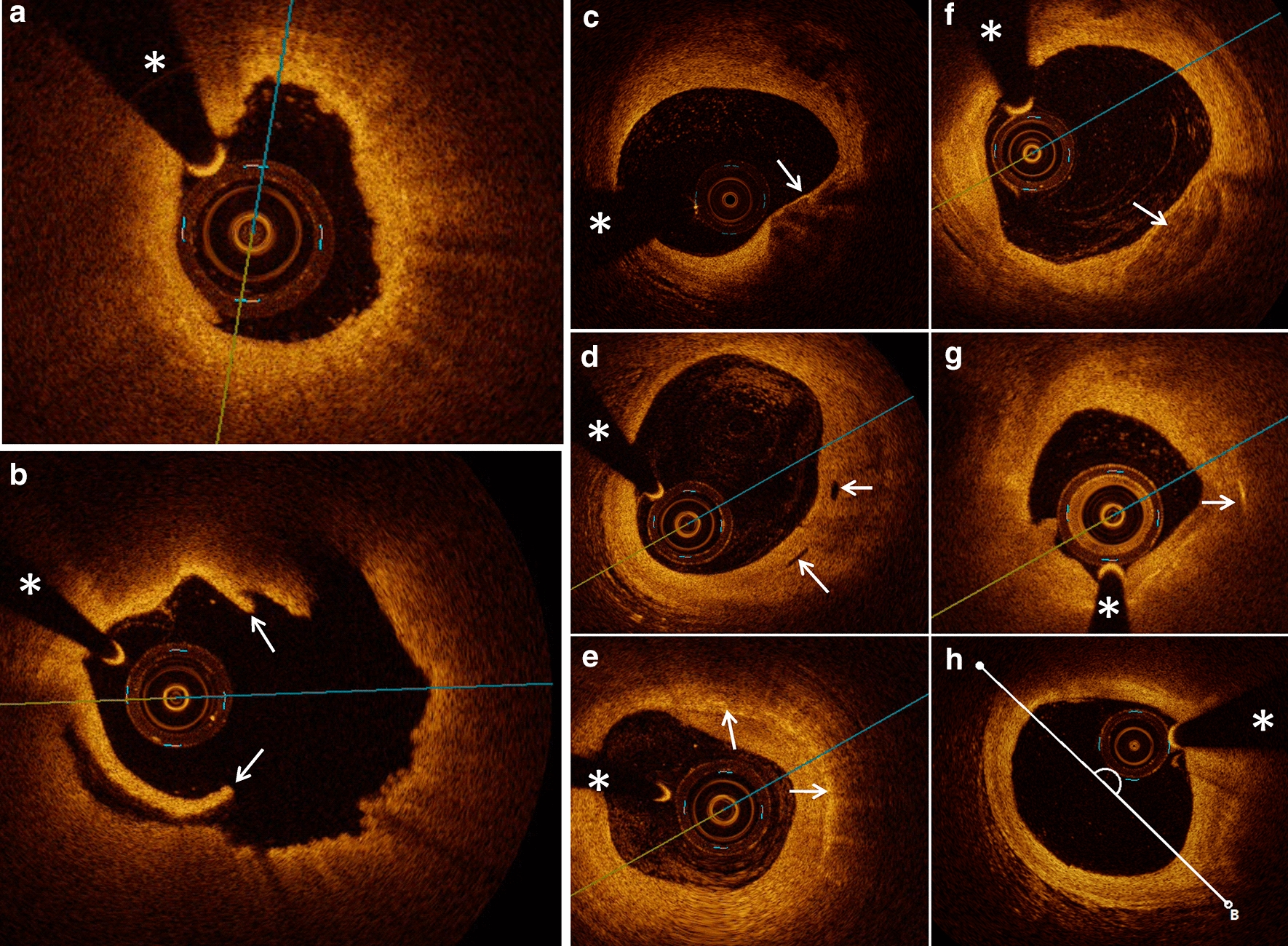 Fig. 1