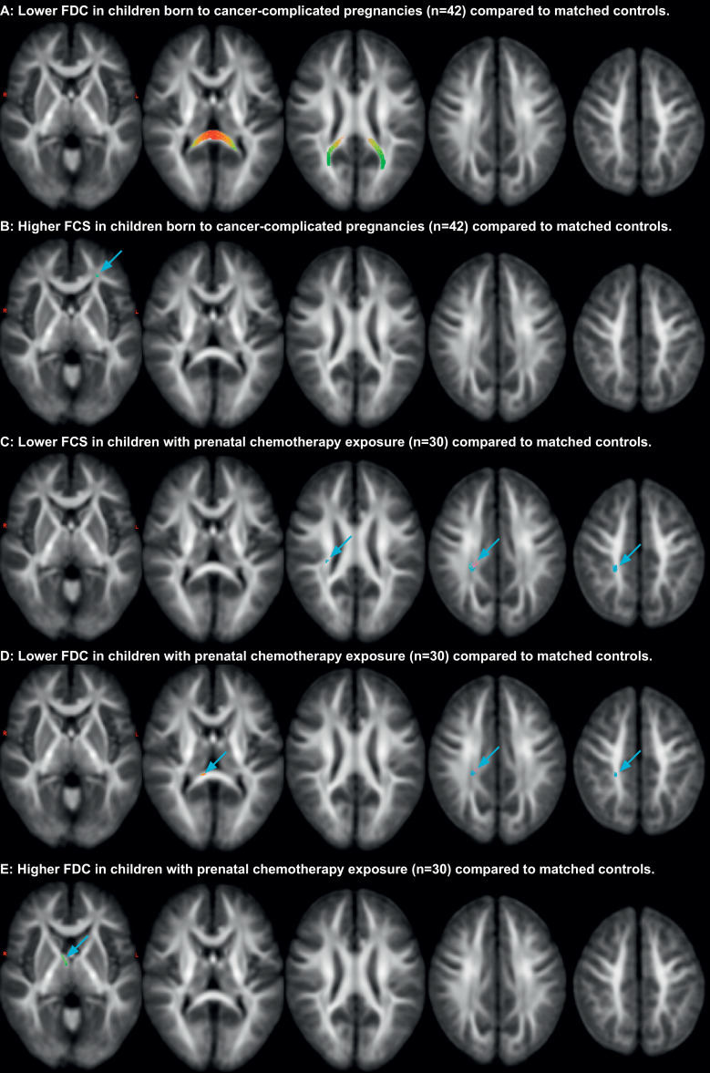 Fig. 2: