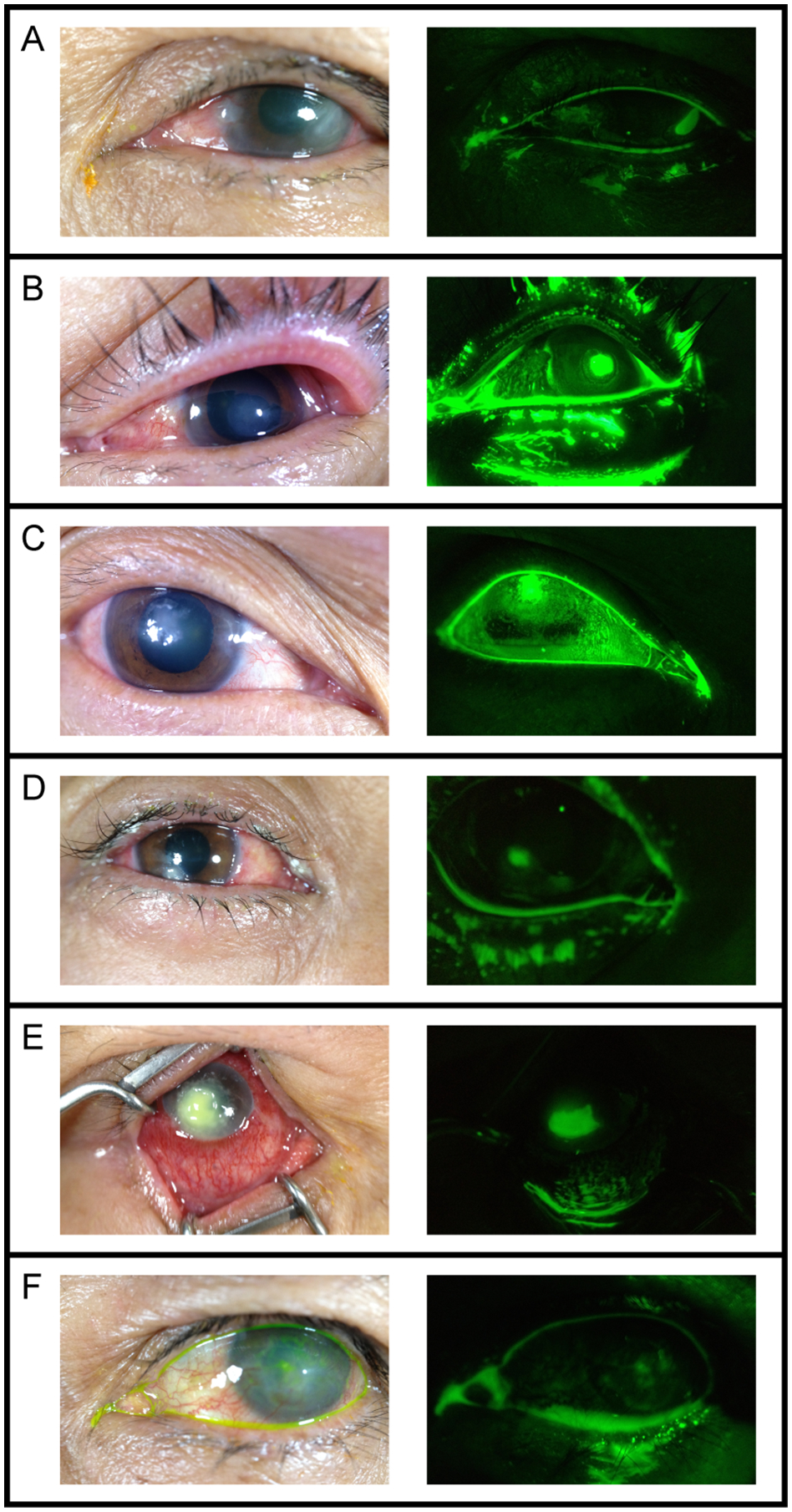 Figure 2: