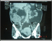 Fig.1