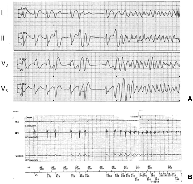 Fig. 1