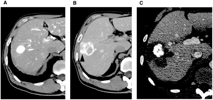 FIG. 1