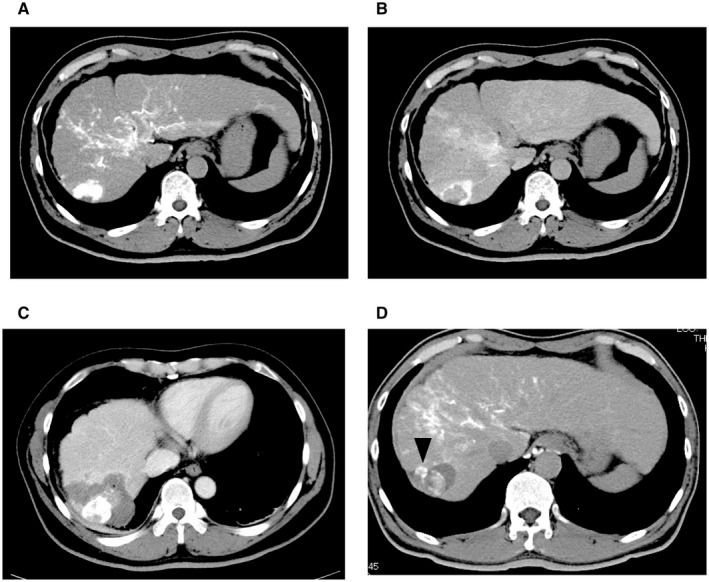 FIG. 3