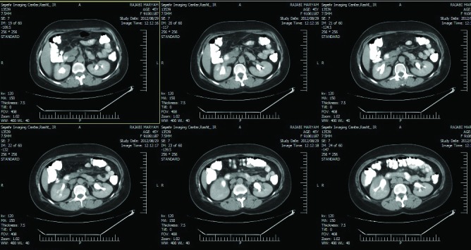 Fig. 1c.