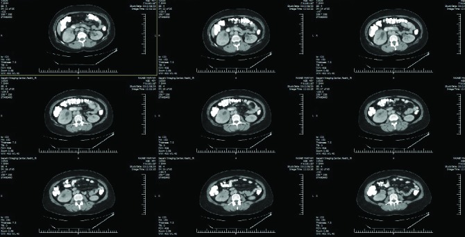 Fig. 1b.