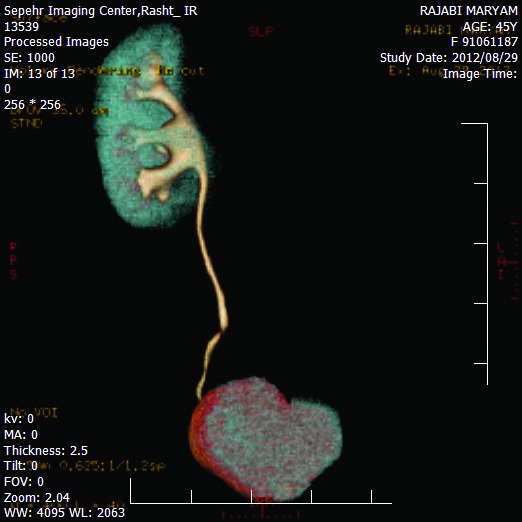 Fig. 1d.