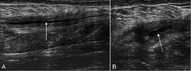 Figure 4 (A, B)