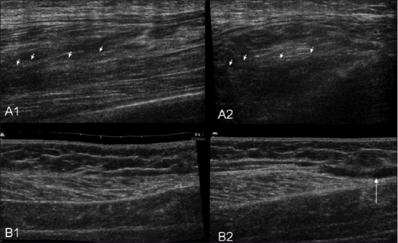 Figure 9 (A, B)