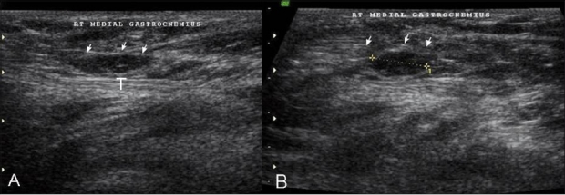 Figure 12 (A, B)