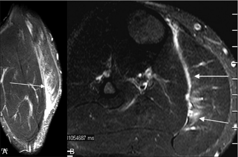 Figure 13 (A, B)