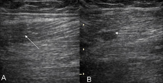 Figure 7 (A, B)