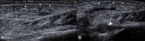 Figure 10 (A, B)