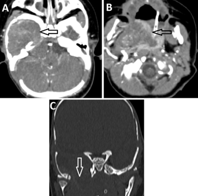 Fig 2