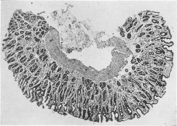 FIG. 7