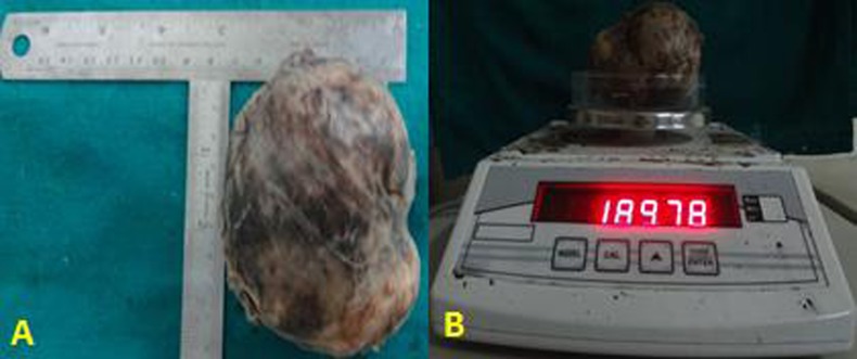 Fig 4