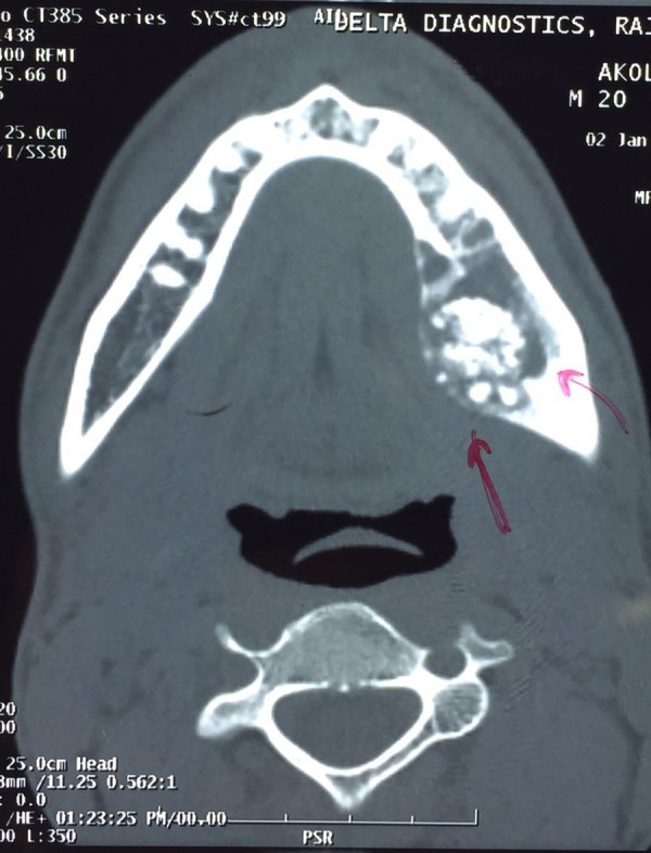 Figure 3