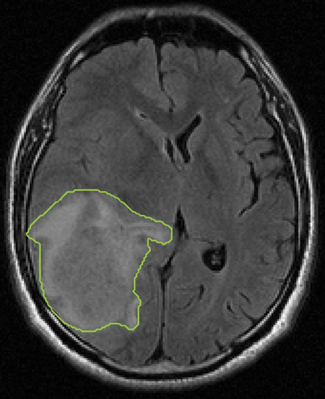 Figure 1b: