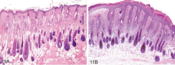 Figure 11.