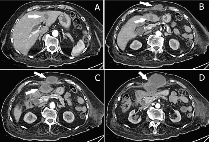 Fig. 1