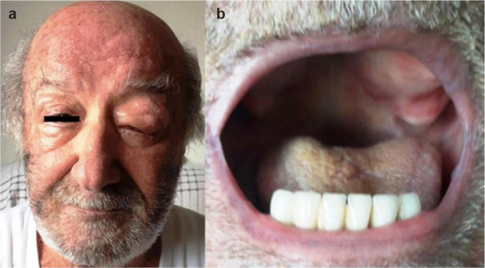 FIG. 1. a, b