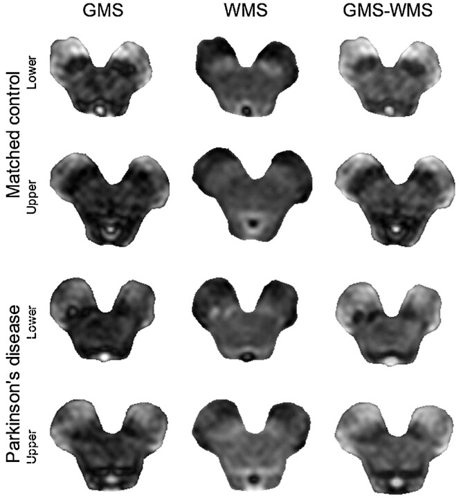 Fig 2.