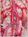Figure 11