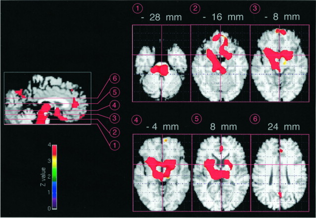 Fig. 1.