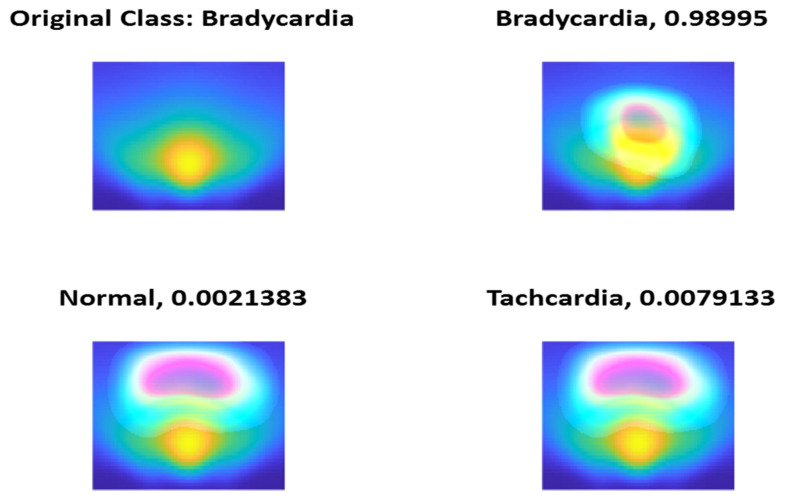 Figure 15