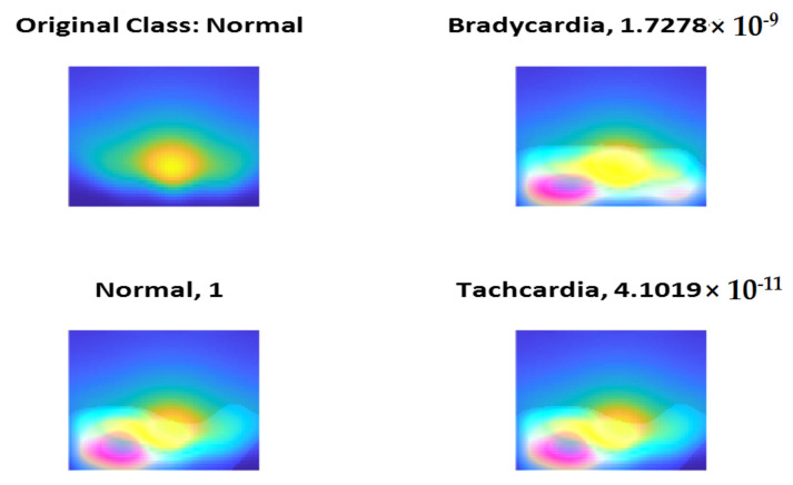 Figure 14