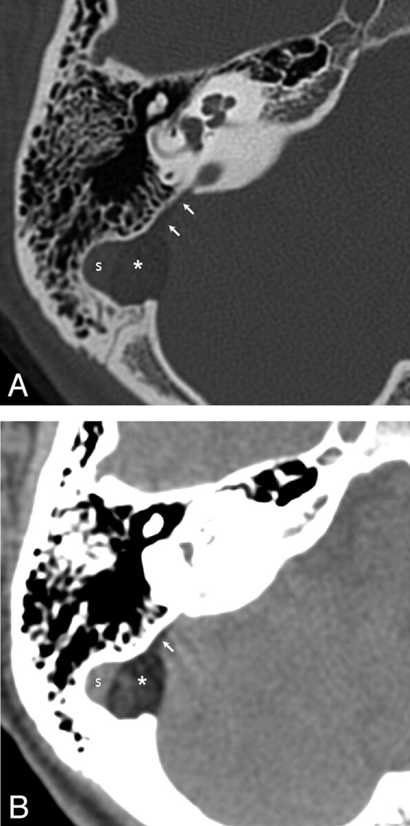 Fig 1.